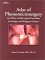 Atlas of Phonomicrosurgery and Other Endolaryngeal Procedures for Benign and Malignant Disease cover