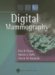 Digital Mammography cover