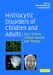  Histiocytic Disorders Of Children And Adults