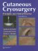 Cutaneous Cryosurgery : Principles And Clinical Practice cover