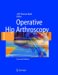  Operative Hip Arthroscopy