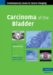 Carcinoma of the Bladder cover