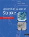  Uncommon Causes of Stroke