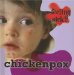 Chickenpox cover