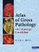  Atlas of Gross Pathology: With Histologic Correlation
