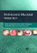 Endoscopic Mucosal Resection cover