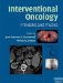  Interventional Oncology: Principles and Practice