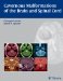 Cavernous Malformations of the Brain and Spinal Cord cover