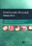 Endoscopic Mucosal Resection [Click for larger image]