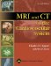 Mri And Ct of the Cardiovascular System cover