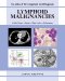 Lymphoid Malignancies : An Atlas of Investigation and Management cover