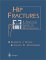  Hip Fractures: A Practical Guide to Management