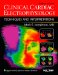  Clinical Cardiac Electrophysiology: Techniques and Interpretations