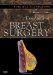  Essentials of Breast Surgery