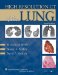 High-Resolution CT of the Lung