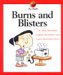  Burns and Blisters