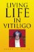  Living Life in Vitiligo