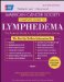  Acs Complete Guide to Lymphedema: Understanding and Managing Lymphedema After Cancer Treatment