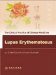  Lupus Erythematosus