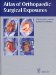  Atlas of Orthopaedic Surgical Exposures