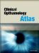  Clinical Ophthalmology Atlas