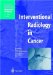  Interventional Radiology in Cancer