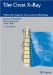 The Chest X-Ray: Differential Diagnosis in Conventional Radiology
