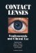  Contact Lenses:: Fundamentals and Clinical Use