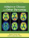 The American Psychiatric Publishing Textbook of Alzheimer's Disease and Other Dementias