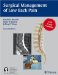  Surgical Management of Low Back Pain