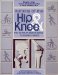  Arthritis of the Hip and Knee: An Active Persons Guide to Taking Charge