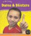  Burns and Blisters