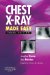  Chest X-Ray Made Easy