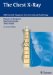 The Chest X-Ray: Differential Diagnosis in Conventional Radiology