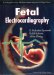  Fetal Electrocardiography
