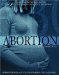  Abortion