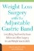  Weight Loss Surgery with the Adjustable Gastric Band: Everything You Need to Know Before and After Surgery to Lose Weight Successfully