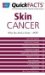  Quickfacts on Melanoma Skin Cancer: What You Need to Know--now
