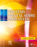 Protesis Dental Sobre Implantes