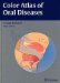  Color Atlas of Oral Diseases