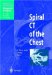  Spiral Ct of the Chest