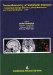  Neurochemistry of Metabolic Diseases: Lysosomal Storage Diseases, Phenylketonuria and Canavan Disease, 2007
