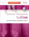  Arthritis & Arthroplasty: The Knee
