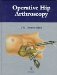  Operative Hip Arthroscopy