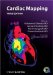  Cardiac Mapping