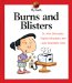  Burns and Blisters