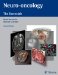  Neuro-Oncology: The Essentials