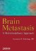  Brain Metastasis: A Multidisciplinary Approach