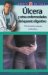  Ulcera Y Otras Enfermedades Del Aparato Digestivo :Prevencion, Causas, Cuidados / Ulcers And Other Illnesses Of The Digestive Tract :Preventions, Causes, Cures: Prevencion, Causas, Cuidados / Prevention, Causes and Care
