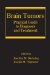  Brain Tumors: Practical Guide to Diagnosis And Treatment